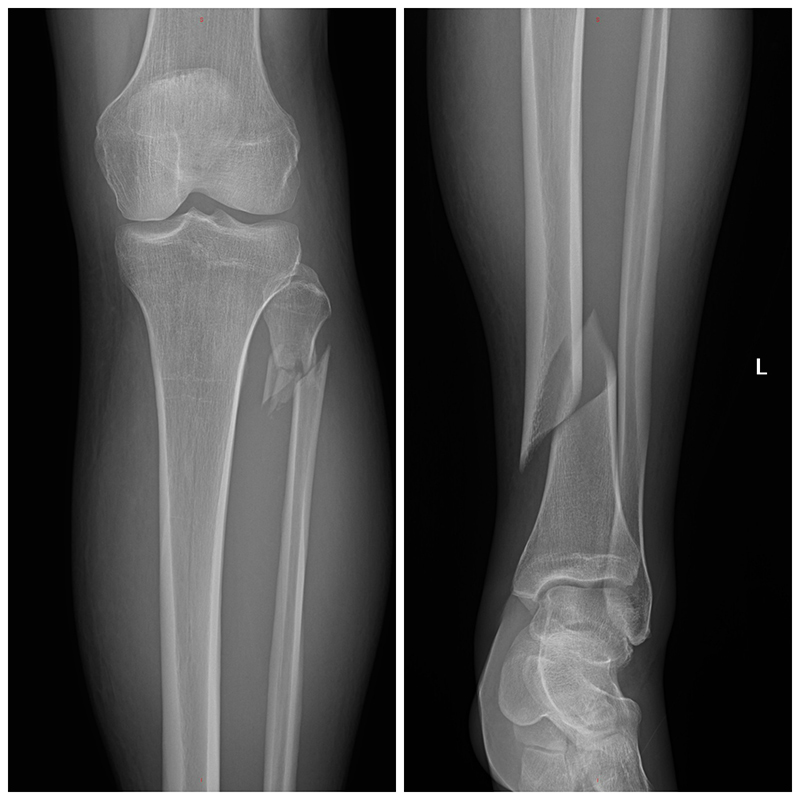 Mishap on the Mosquito Coast body image 6